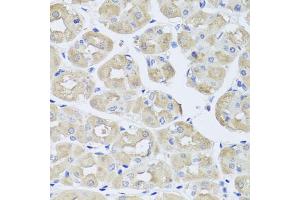 Immunohistochemistry of paraffin-embedded human stomach using BGLAP antibody (ABIN5975009) at dilution of 1/100 (40x lens). (Osteocalcin antibody)