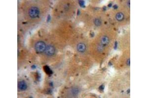 Used in DAB staining on fromalin fixed paraffin-embedded Liver tissue (IGF2 antibody  (AA 25-91))