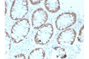 Formalin-fixed, paraffin-embedded human Colon stained with CDX2 Mouse Monoclonal Antibody (rCDX2/1690). (Recombinant CDX2 antibody  (AA 150-249))