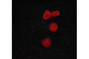 ABIN6269067 staining Hela cells by ICC/IF.
