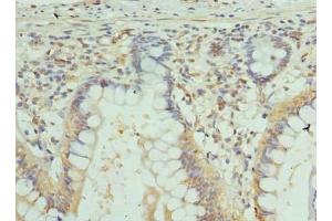 Immunohistochemistry of paraffin-embedded human small intestine tissue using ABIN7153593 at dilution of 1:100 (GJA4 antibody  (AA 231-333))