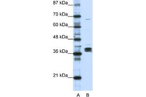 WB Suggested Anti-HNRPDL Antibody Titration:  1. (HNRPDL antibody  (Middle Region))