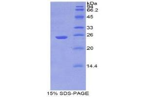 SDS-PAGE (SDS) image for Aminopeptidase Puromycin Sensitive (NPEPPS) (AA 584-793) protein (His tag) (ABIN1080609)