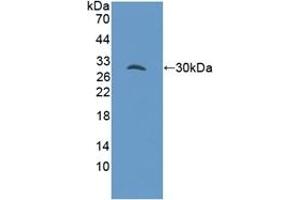 Detection of Recombinant GAB3, Mouse using Polyclonal Antibody to GRB2 Associated Binding Protein 3 (GAB3) (GAB3 antibody  (AA 142-375))