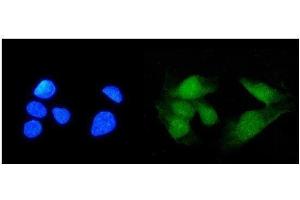 IF analysis of TRIM21/SS-A using anti-TRIM21/SS-A antibody (ABIN7599820). (TRIM21 antibody  (AA 12-475))