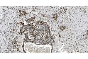 IHC analysis of HP1 alpha/CBX5 using anti-HP1 alpha/CBX5 antibody (ABIN7599057). (CBX5 antibody  (AA 1-191))