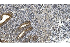 IHC analysis of NOX2/gp91phox/CYBB using anti-NOX2/gp91phox/CYBB antibody (ABIN7599875). (CYBB antibody  (AA 124-559))