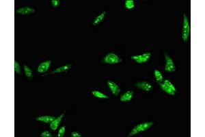 Immunofluorescent analysis of Hela cells using ABIN7150275 at dilution of 1:100 and Alexa Fluor 488-congugated AffiniPure Goat Anti-Rabbit IgG(H+L) (RAD54B antibody  (AA 1-167))