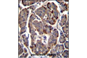 RAB11B Antibody (C-term) (ABIN1881719 and ABIN2846071) immunohistochemistry analysis in formalin fixed and paraffin embedded human pancreas tissue followed by peroxidase conjugation of the secondary antibody and DAB staining. (RAB11B antibody  (C-Term))