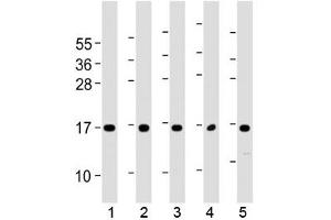 Western blot testing of human 1) 293T/17, 2) HUVEC, 3) K562, 4) NCI-H460 and 5) PC-3 cell lysate with Eotaxin-3 antibody at 1:2000. (CCL26 antibody  (AA 58-92))