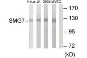 Western blot analysis of extracts from HeLa/Jurkat/293/HuvEc cells, using SMG7 Antibody.