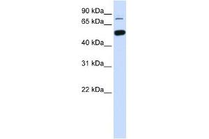 SMARCD1 antibody used at 1 ug/ml to detect target protein. (SMARCD1 antibody  (Middle Region))