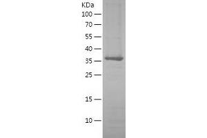 Western Blotting (WB) image for DNA Repair Protein Homolog 1 (RAD51) (AA 2-339) protein (His tag) (ABIN7122684) (RAD51 Protein (AA 2-339) (His tag))
