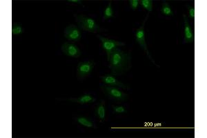 Immunofluorescence of monoclonal antibody to NR4A2 on HeLa cell. (NR4A2 antibody  (AA 71-170))