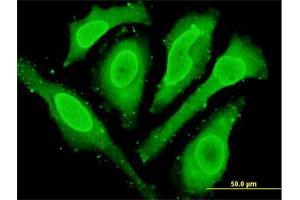 Immunofluorescence of monoclonal antibody to CYGB on HeLa cell. (CYGB antibody  (AA 1-190))