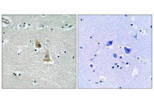 Immunohistochemistry (IHC) image for anti-Neutrophil Cytosol Factor 1 (NCF1) (Ser345) antibody (ABIN1848361) (NCF1 antibody  (Ser345))