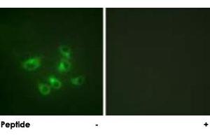 Immunofluorescence analysis of HepG2 cells, using TPH1 polyclonal antibody . (Tryptophan Hydroxylase 1 antibody  (AA 25-75))