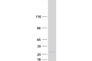 Western Blotting (WB) image for Cytokine Induced Apoptosis Inhibitor 1 (CIAPIN1) protein (Myc-DYKDDDDK Tag) (ABIN2714679)