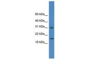 Image no. 1 for anti-Cystatin 8 (CST8) (AA 81-130) antibody (ABIN6745332) (CST8 antibody  (AA 81-130))