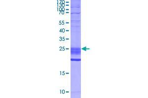 Image no. 1 for Ectodysplasin A (EDA) (AA 245-389) protein (His-DYKDDDDK-Strep II Tag) (ABIN5569916)