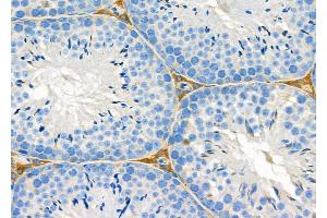 ABIN6263482 and ABIN6279565 at 1/100 staining Mouse testis tissue by IHC-P. (MYO5C antibody  (Internal Region))