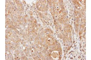 IHC-P Image Immunohistochemical analysis of paraffin-embedded N87 xenograft, using PDE9A, antibody at 1:500 dilution. (PDE9A antibody  (N-Term))
