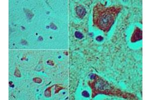 Image no. 1 for anti-T Brachyury Protein (AA 350-400) antibody (ABIN960367) (T Brachyury Protein (AA 350-400) antibody)