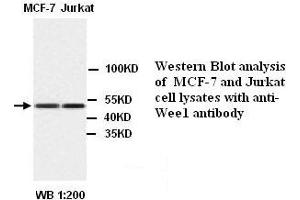 Image no. 1 for anti-Enolase 1 (ENO1) antibody (ABIN790967) (ENO1 antibody)