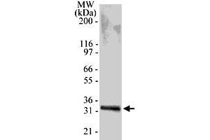 Western blot analysis of 0. (TACI antibody  (AA 116-132))