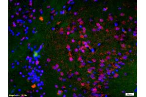 Formalin-fixed and paraffin embedded rat brain labeled with Anti-Histone H3 (Di Methyl K9) Polyclonal Antibody, Unconjugated (ABIN703886) at 1:200 followed by conjugation to the secondary antibody Goat Anti-Rabbit IgG, Cy3 conjugated used at 1:200 dilution for 40 minutes at 37 °C and DAPI staining (Histone 3 antibody  (H3K9me))