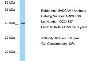 Western Blotting (WB) image for anti-Mucosal Vascular Addressin Cell Adhesion Molecule 1 (MADCAM1) (C-Term) antibody (ABIN2789480) (MADCAM1 antibody  (C-Term))