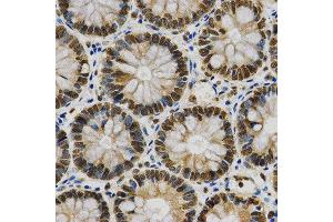 Immunohistochemistry (IHC) image for anti-Heterogeneous Nuclear Ribonucleoprotein A2/B1 (HNRNPA2B1) (AA 1-180) antibody (ABIN3021593)