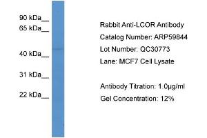 Western Blotting (WB) image for anti-Ligand Dependent Nuclear Receptor Corepressor (Lcor) (C-Term) antibody (ABIN2774271)