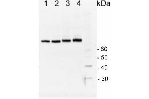 Image no. 2 for anti-Heat Shock Protein 70 (HSP70) (Cytoplasmic) antibody (ABIN334584)