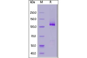 Human HGF, Fc Tag on  under reducing (R) condition. (HGF Protein (AA 32-728) (Fc Tag))