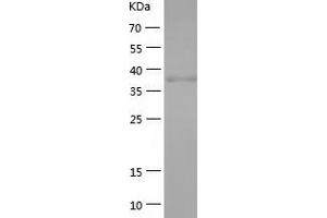 Western Blotting (WB) image for Paraneoplastic Antigen MA1 (PNMA1) (AA 1-353) protein (His tag) (ABIN7287962) (PNMA1 Protein (AA 1-353) (His tag))