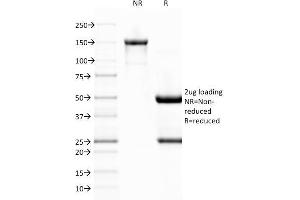 SDS-PAGE Analysis Purified vWF Monoclonal Antibody (VWF/1767). (VWF antibody  (AA 1815-1939))