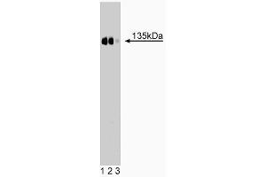Western blot analysis of CD49c (integrin alpha3) on a rat kidney lysate. (ITGA3 antibody  (AA 110-325))