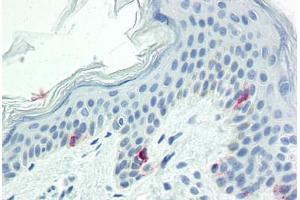 Immunohistochemistry (Paraffin-embedded Sections) (IHC (p)) image for anti-Tyrosinase (TYR) (AA 1-433) antibody (ABIN573956)