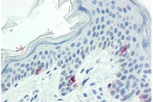 Human Skin (formalin-fixed, paraffin-embedded) stained with TYR antibody ABIN573956 at 10 ug/ml followed by biotinylated anti-mouse IgG secondary antibody ABIN481714, alkaline phosphatase-streptavidin and chromogen. (TYR antibody  (AA 1-433))