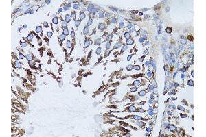 Immunohistochemistry of paraffin-embedded rat liver using β-actin antibody. (beta Actin antibody)