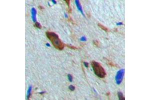 Immunohistochemical analysis of MSK1 staining in human brain formalin fixed paraffin embedded tissue section. (MSK1 antibody  (Center))