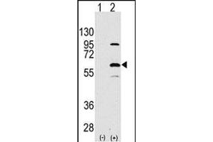 Western blot analysis of ELP3(arrow) using rabbit polyclonal ELP3 Antibody (N-term) (ABIN387966 and ABIN2844714). (ELP3/KAT9 antibody  (N-Term))