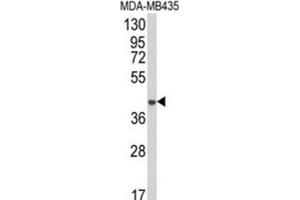Western Blotting (WB) image for anti-1-Acylglycerol-3-Phosphate O-Acyltransferase 4 (AGPAT4) antibody (ABIN3003878) (AGPAT4 antibody)