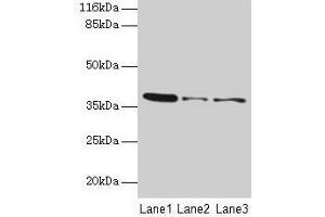Western blot All lanes: MAS1 antibody at 2 μg/mL Lane 1: 293T whole cell lysate Lane 2: Colo320 whole cell lysate Lane 3: HepG2 whole cell lysate Secondary Goat polyclonal to rabbit IgG at 1/10000 dilution Predicted band size: 38 kDa Observed band size: 38 kDa (MAS1 antibody  (AA 285-325))