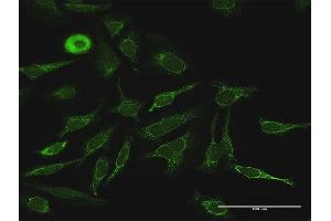 Immunofluorescence of purified MaxPab antibody to PDK4 on HeLa cell. (PDK4 antibody  (AA 1-411))