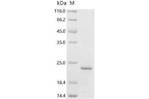 Activating Signal Cointegrator 1 Complex Subunit 3 (ASCC3) (AA 1-111), (full length) protein (His tag)