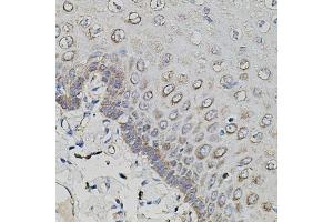 Immunohistochemistry of paraffin-embedded human esophagus using APP antibody (ABIN3020679, ABIN3020680, ABIN3020681 and ABIN6213663) at dilution of 1:100 (40x lens). (APP antibody  (AA 190-290))