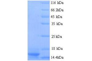 SDS-PAGE (SDS) image for Prothymosin, alpha (PTMA) (AA 2-112) protein (His tag) (ABIN5713766) (PTMA Protein (AA 2-112) (His tag))