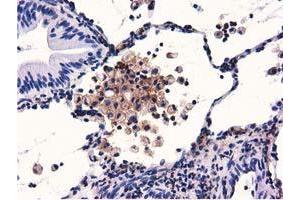 Immunohistochemistry (IHC) image for anti-Growth Arrest-Specific 7 (GAS7) antibody (ABIN1498379)